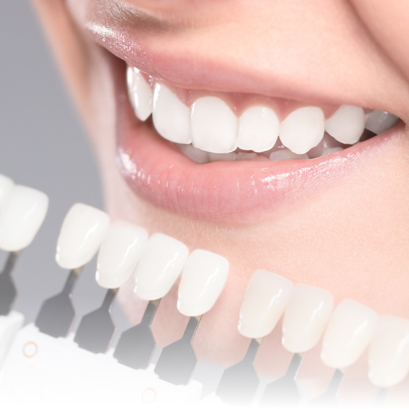 女性口元のきれいな歯と歯の白さの指標の写真