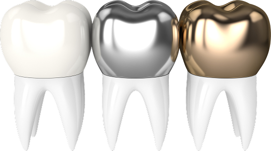 クラウンの3D画像